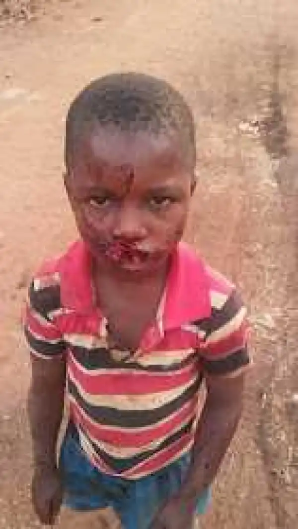 Mentally unstable man brutalizes son in Imo State (graphic photo)